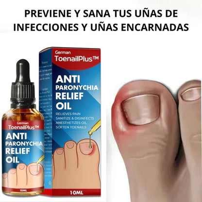 Toenail Plus | Tratamiento para eliminar hongos de uña 100% natural