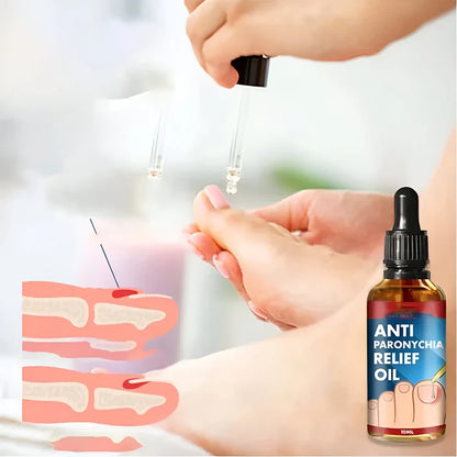 Toenail Plus | Tratamiento para eliminar hongos de uña 100% natural